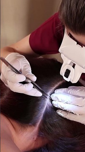 ASMR School Nurse LICE Check on Scalp and Neck | Removal with Tweezers #asmr #shorts #shortvideos