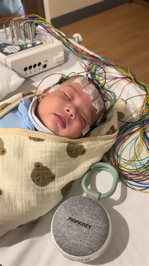 Portable Sound Machine Benefits for EEG Sleep Tests