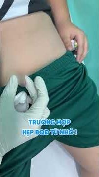 Thăm khám cho bé trai bị HẸP BAO QUY ĐẦU từ nhỏ