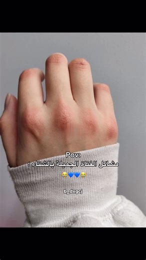 ‎مختلفـــ𓅂ᬽـــه‎ on Instagram: "Follow me: @b_dxgcj #foryou#fpy"