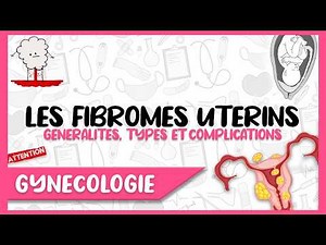 Les FIBROMES UTÉRINS: les Complications et les risques s’ils sont associés à la grossesse