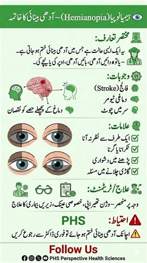 Hemianopia | Loss of Half Your Vision | Vision Loss | #eyehealth #eyecare