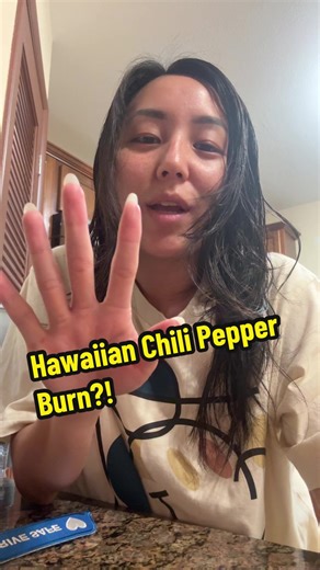 How do you stop the burning on skin from Hawaiian chili peppers? 🌶️ It feels like I burned my fingers on a hot surface but only my nerves or something sting a bit. If you have any advice please let me know 😁 #hawaiianchilipepper #sendhelp #advice #whatdoido #fyp