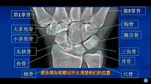 影像解剖基础：腕关节8块骨如何快速记住？医生教你口诀