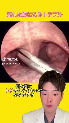 魚の骨が喉に刺さった時の対処法