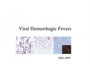 viral hemorrhagic fevers - SlideServe