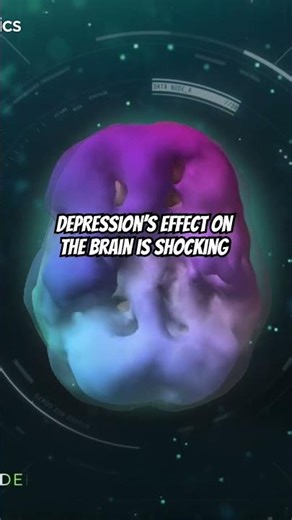 How a Brain SPECT Scan Can Help Treat Depression