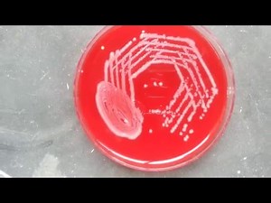 Moraxella catarrhalis