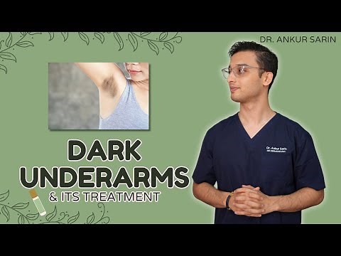 Dark Underarm Treatment | Dark Underarms Whitening | Acanthosis Nigricans | Dr. Ankur Sarin
