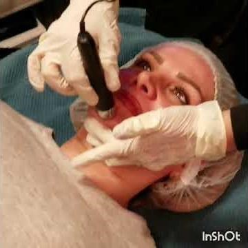 How to measure skin hydration, pigmentation and sebum by MC750?