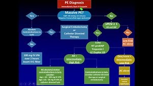 Cleveland Clinic PERT Algorithm