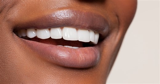 Dentists Are Begging You To Stop Using These Viral Teeth-Whitening Hacks