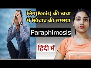 What is paraphimosis|Paraphimosis reduction|paraphimosis causes and symptoms|treatment|
