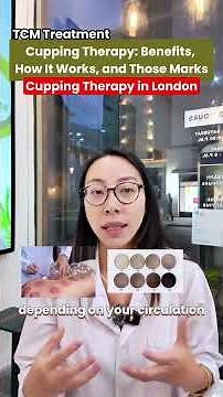 Cupping Therapy Explained | How Cupping Supports Women’s Health & Fertility | GinSen London