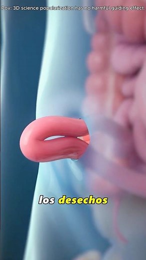 How A Colostomy Bag Works(3D Animation)#colostomy #ostomywarrior #medicaltechnology