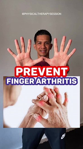 1.1M views · 23K reactions | Unlocking the Secret to Healthy Hands: Embrace Finger Arthritis Prevention with Targeted Exercises! #arthritis #arthritisrelief #arthritispain #arthritistreatment #arthritisawareness #foryou #foryoureels #foryoupage #fbreelsviral #fbreelsvideo #fyp #fypシ #physiotherapy #physio #physiotherapist #physicaltherapy #physicaltherapist #physicaltherapysession | Physical Therapy Session | Facebook