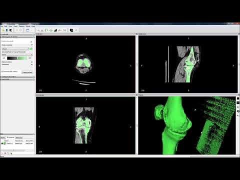 Proto 3D - Como extrair modelos 3D de Tomografias