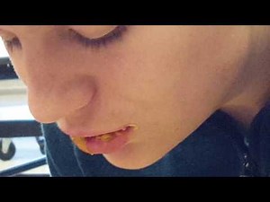 KID THROWS UP EVERYWHERE FROM SCHOOL LUNCH