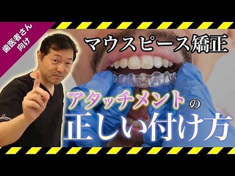 《前編》アタッチメント付け方とその手順【ニューヨーク大学補綴科卒の歯科医師が詳しく解説】