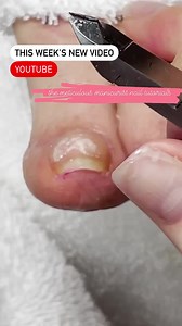 729K views · 3.8K reactions | Curious as to what the dark spots are...