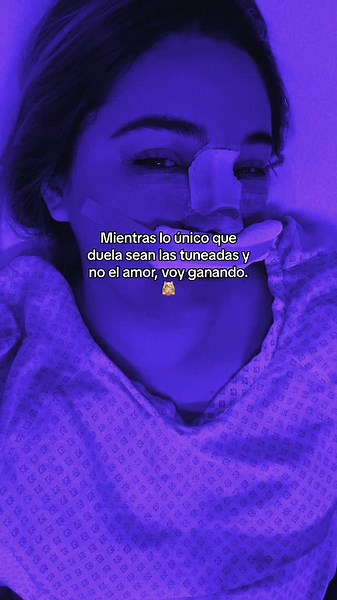 Transforma tu 2024 con rinoplastia tuneada