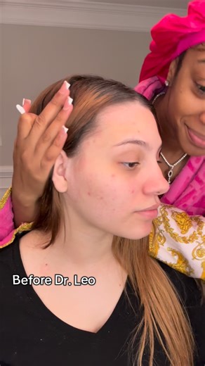 Keeyah The Creator🎥🔑 | Dr Leo 7 Day Treatment @dr.leoofficial #drleodryinglotion #salicylicacid #acne | Instagram