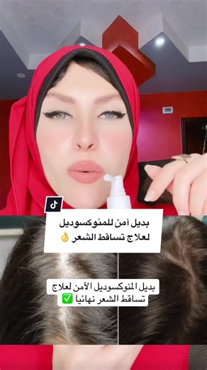 علاج تساقط الشعر باستخدام Redixil Pro Hair Lotion