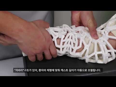 [Official] 오픈캐스트 Long Arm (LA) 시술 가이드