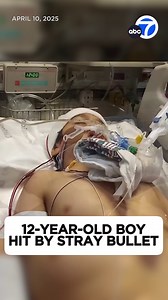 778K views · 13K reactions | Heartbreaking: A 12-year-old boy has a long road to recovery after he was shot in the head by a stray bullet when a violent argument between two men ended in gunfire at a park in Ontario, California. Read more at https://abc7.la/42CPPrH | ABC7 | Facebook