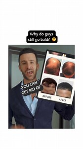 5.8K views · 7 comments | Genetic hair loss affects 50 million men in the United States. Fortunately, the science behind hair regrowth is no longer a pipe dream. #hairgrowth #hairlosstreatment #locklab | Locklab | Facebook