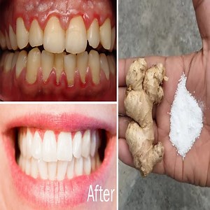 438K views · 44K reactions | In just two minutes, white teeth whiten and shiny like pearls, this recipe / treatment at home. | ELEGANT BEAUTY | Facebook
