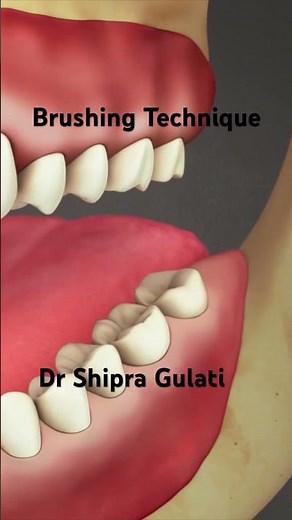 Brushing Technique : Modified Bass Technique