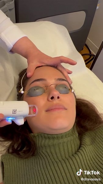 Effective Treatment for Spider Angioma | One-Time Solution!