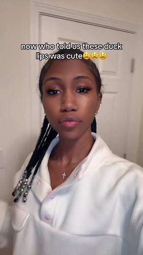 The Duck Lips Trend: Love It or Hate It?