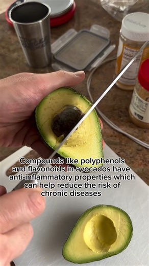 🥑Avocado lovers unite! These green gems are delicious and packed with healthy fats and loads of vitamins. Avocados nourish your body from within and even help your skin glow ✨! #avocado #AvocadoBenefits #AvocadoLover #HealthyEating #Nutrition #NutritionFacts #HealthyFood #HealthyLifestyle #HealthyFats #fruit | MDVIP