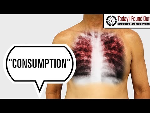 Why Was Tuberculosis Called Consumption?