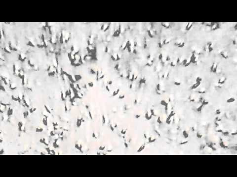 Human sperm under a microscope with 400x zoom