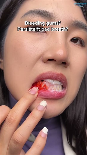 Dental Water Flosser – Deep Teeth Cleaning & Gum Care | Dropshipping Video Ad #amazonfinds