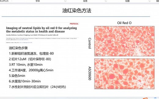 最全油红染色的Image J定量，批量处理和作图