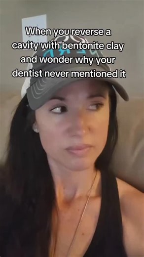 How to reverse ⏮️ Cavities 🦷? Everyone’s saying you can reverse cavities with toothpaste… but is that actually true? Let’s get real.” ⸻ Body: Here’s the truth: 🦷 A cavity starts as a microscopic loss of minerals in your enamel — this is called demineralization. It happens when bacteria in your mouth feed on sugar and produce acid that eats away at enamel. Now — if it’s caught early, before a hole forms — your enamel can repair itself naturally through a process called remineralization. That’s 