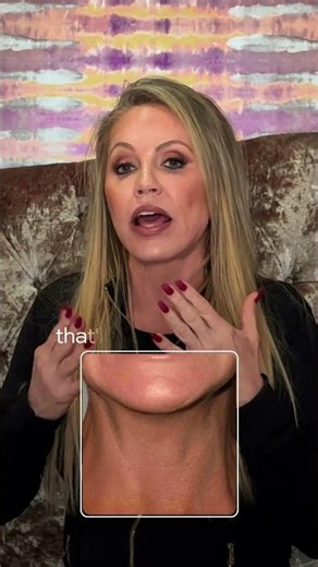 Can Botox Fix Jawline & Neck Aging