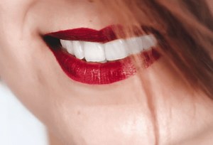 How to Whiten Your Teeth in 1 Day [Using 19 Tricks]