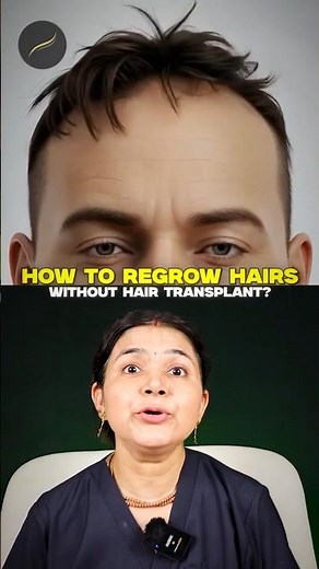 How to Regrow Hairs without Hair Transplant! #hairgrowth #hairtransplant