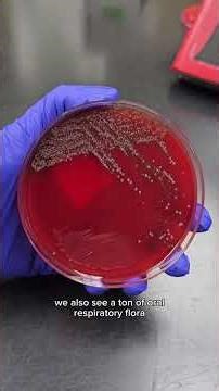 Group A Strep Culture #medlab #mltstudents #microbiology