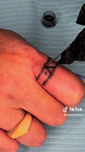 My grandfather would be proud #inuittattaoo #inuitculture This meant so much to me especially as an artist. It was important to me for my hands to represent who I am. Only 7 more fingers to go!