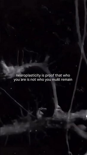 Neuroplasticity is beautiful #neuroplasticity #neuroscience