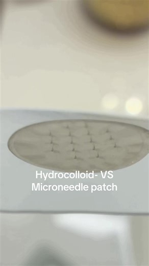 Hydrocolloid vs. Microneedle Acne Patches