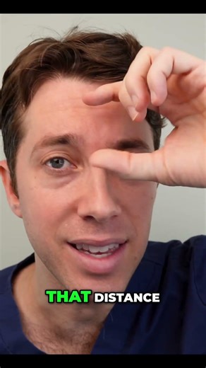 Hairline Lowering Surgery Explained How to Restore Facial Balance