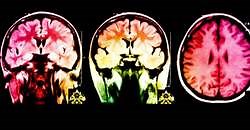 The Most Relaxing Song On Earth