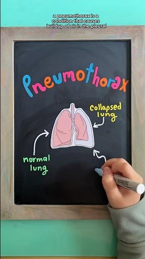 PNEUMOTHORAX #nursing